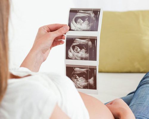 تناول هذا المسكن أثناء الحمل يؤثر على خصوبة مولودها الذكر